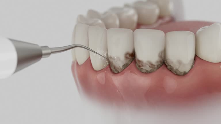 Trusted Teeth Cleaning And Checkup service in Winters, CA - Dentist Open Now